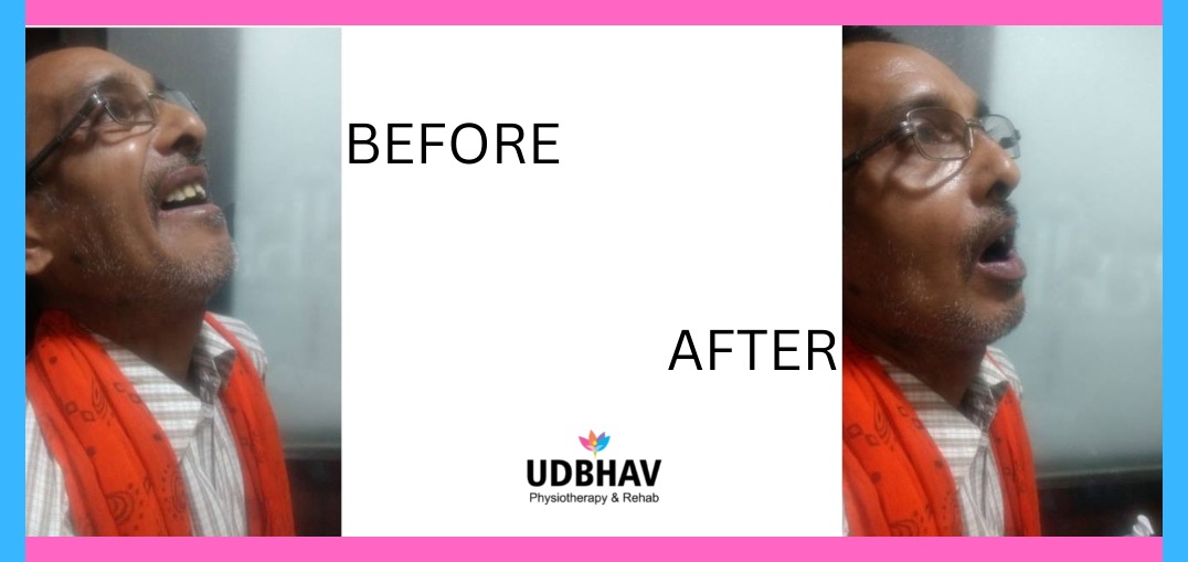 udbhav rehab