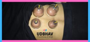 cup therapy udbhav